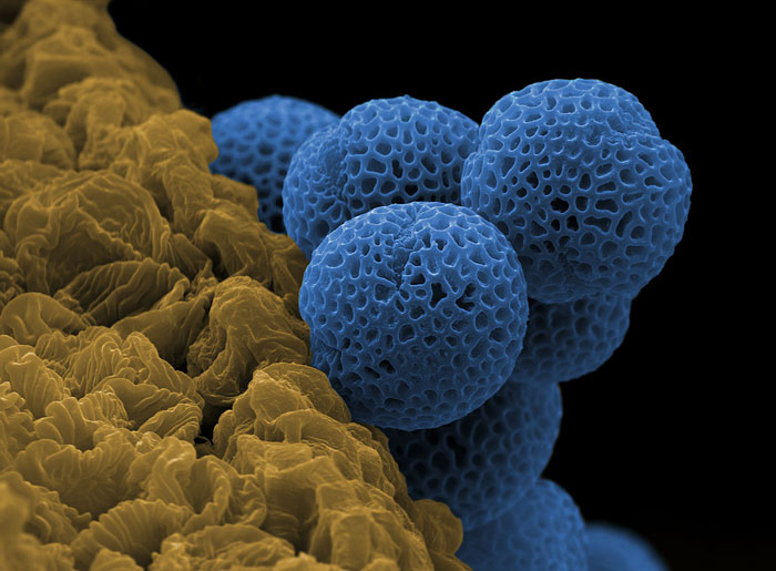 Privet - scannong electron microscope by Peter Rowley